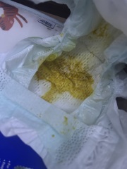 Baby poo worries ( warning baby poo pics )