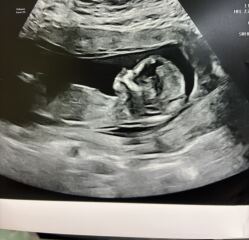 Boy or Girl 💙💕