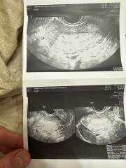 First US and doctor is not sure