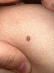 Moles