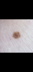Moles