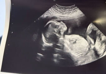 Boy or girl? Scan