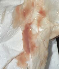 is this amount of spotting normal?