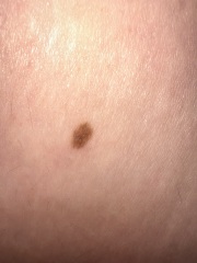 Moles