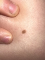 Mole