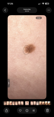 Moles