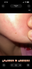 Moles