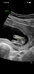 Scan predictions 💙💗