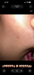 Moles