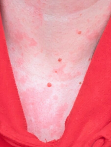 What are you up to today if you have a chronic illness? Thread 5