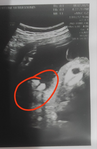 Is this a boy on scan photo?