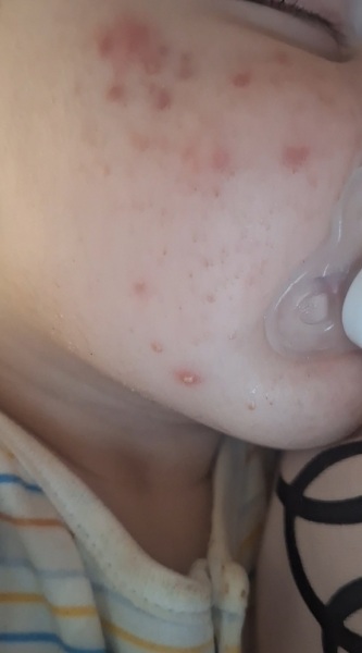 What are these spots?