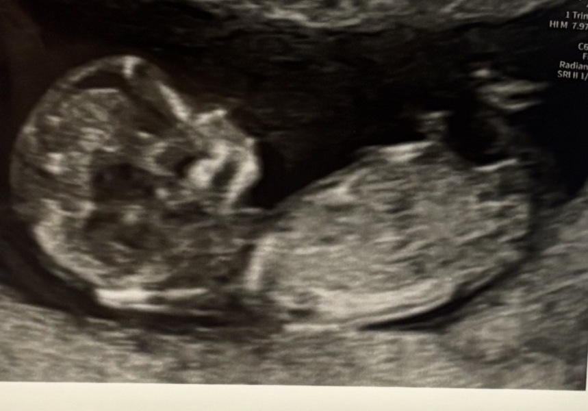 Due September 2026 🐣💖🙏🤞