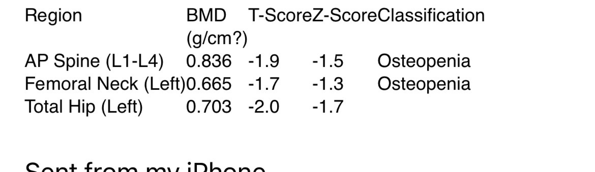MNHQ here: Got questions about osteoporosis?  AMA with Royal Osteoporosis Society specialist nurses Kirsty Carne and Julia Thomson, Thurs 26th Feb @ 7pm