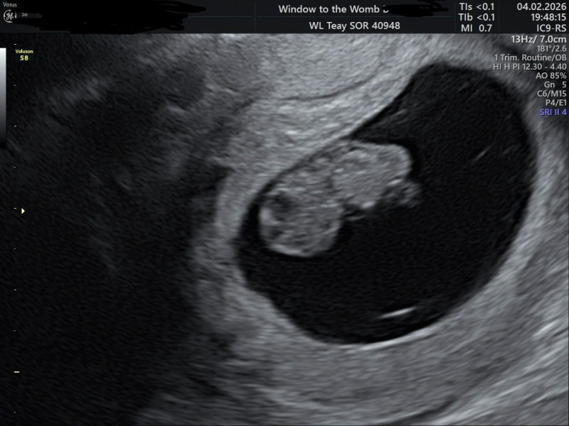 Due September 2026 🐣💖🙏🤞