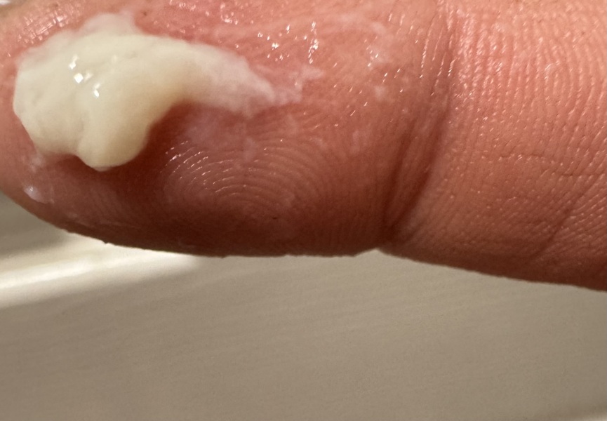 12dpo CM discharge before BFP?