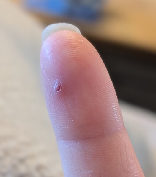 How do you keep your finger covered for weeks on end?!