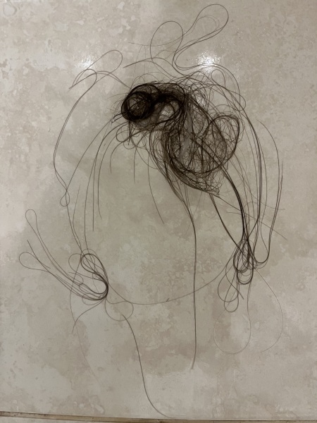 Is this amount of hair loss normal? Picture included