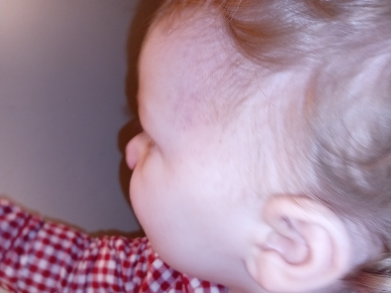 Can't identify rash on baby's face