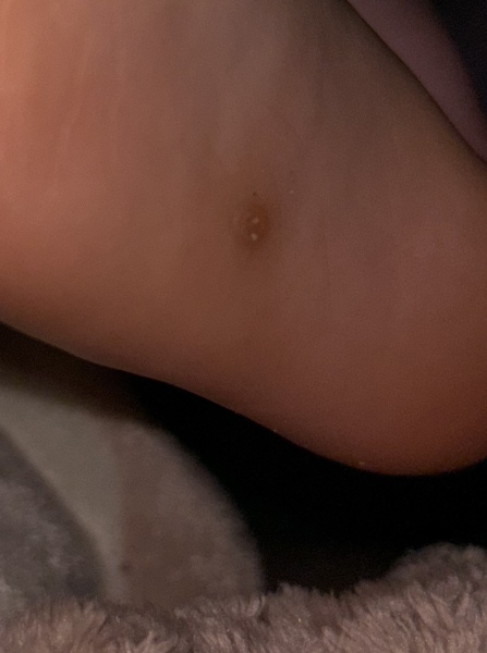 What ask what is this??