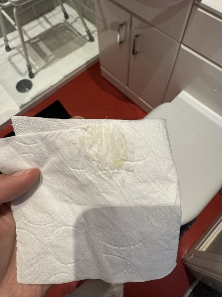 TMI PHOTO INCLUDED. Is this normal pregnancy discharge?