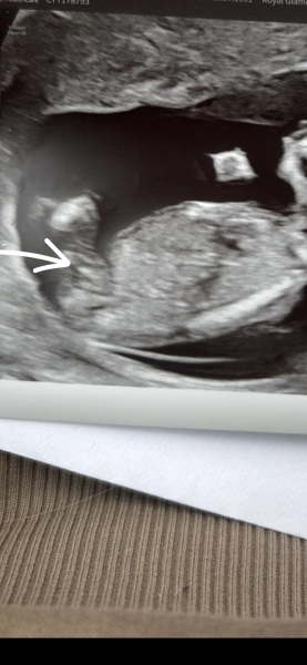 Is this male genitals?
