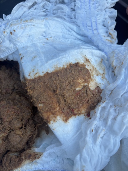 2-year-old’s nappy