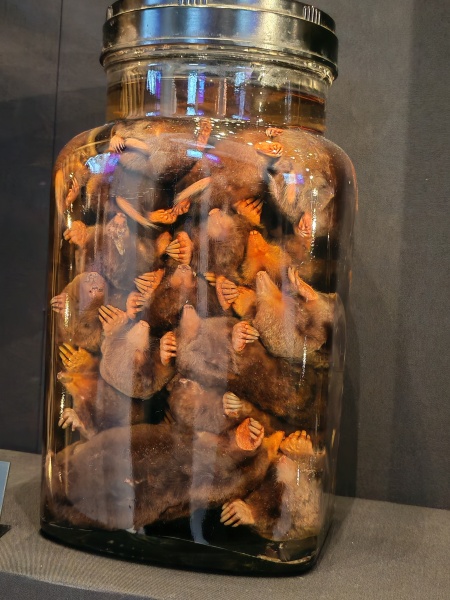 Retroperitoneal Leiomyosarcoma part 2