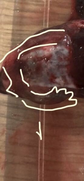 7 week loss - what is this (graphic)