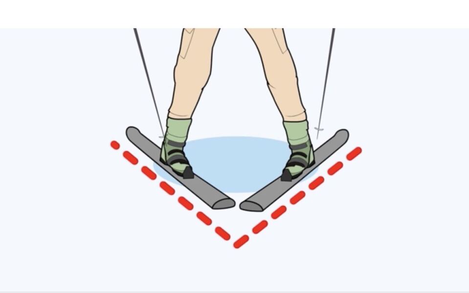 When your child cant move feet inwards