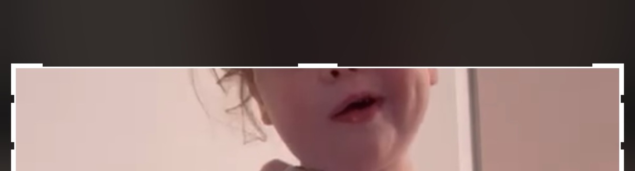 Toddler facial spasm