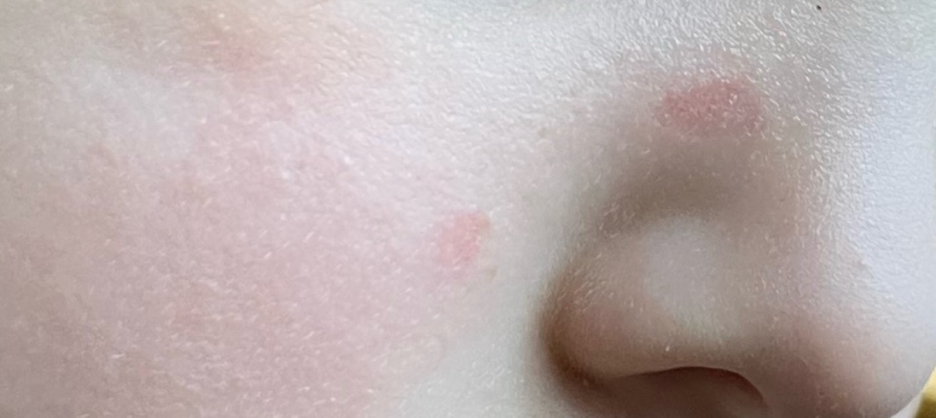 Is this going to scar?