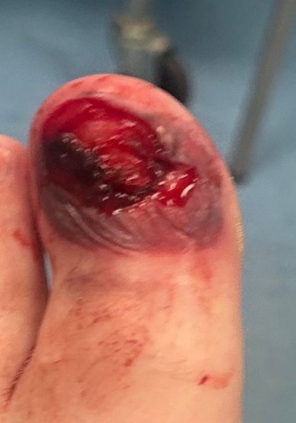 Does this need medical attention? (Yucky photo included)