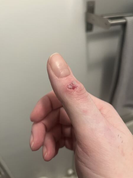 Does this need looking at? Grim photo