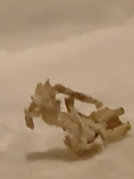 <klaxon> WTF has just come out of my nose? Pic included. It's grim.