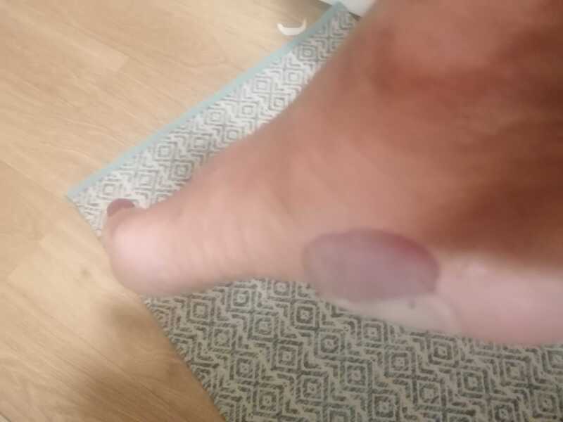 Does this need medical attention? (Yucky photo included)