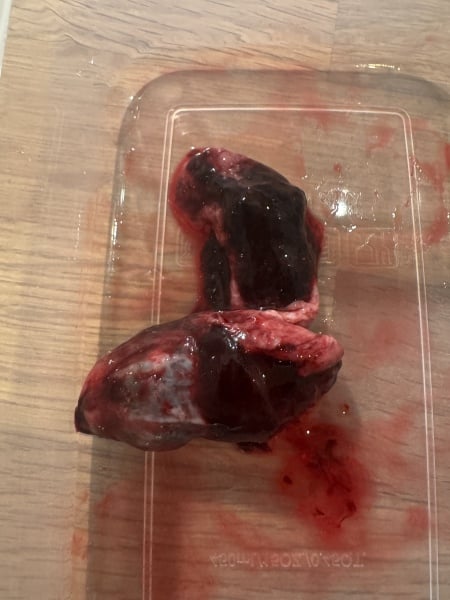 7 week loss - what is this (graphic)