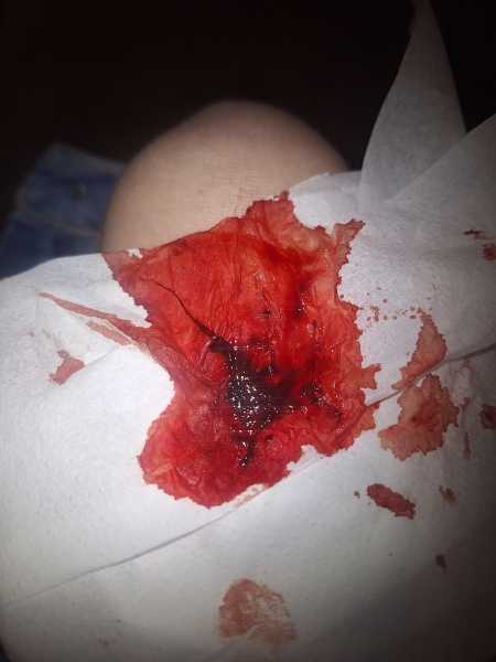 Is this a miscarriage?