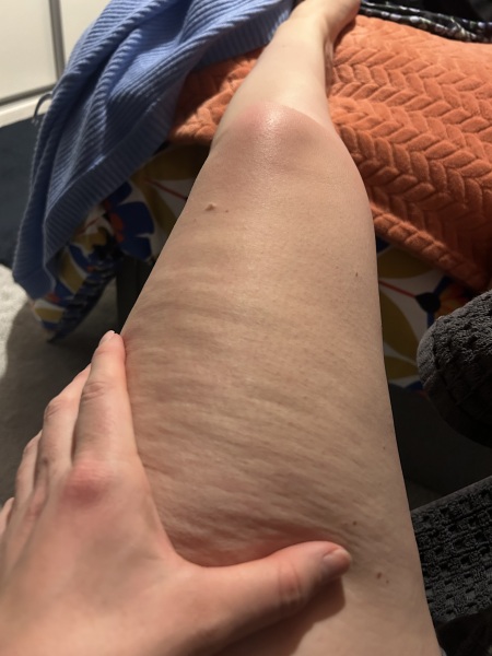 Are my thighs normal?