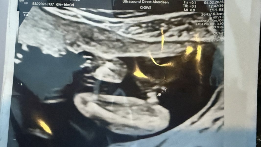 Boy or girl potty shot