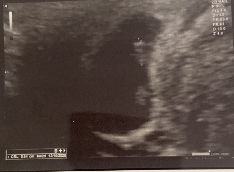 Had early scan told just one but looks like two?