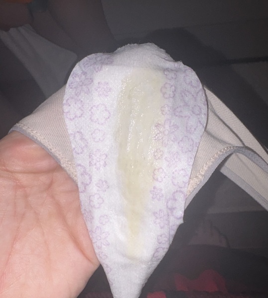 I felt a gush and this came out? Should I be concerned? 31 weeks pregnant.