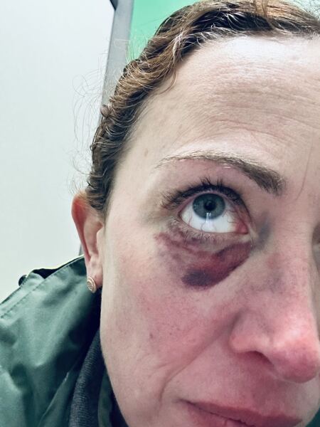 Injuries inflicted or caused by your dog