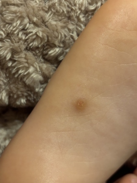 What ask what is this??