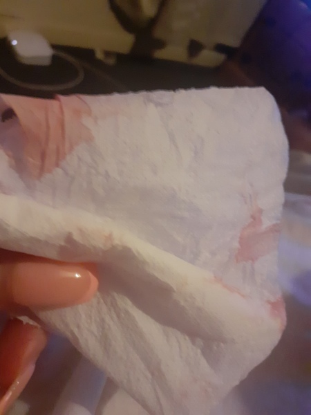 Help ...Bleeding 8 days before period is due.