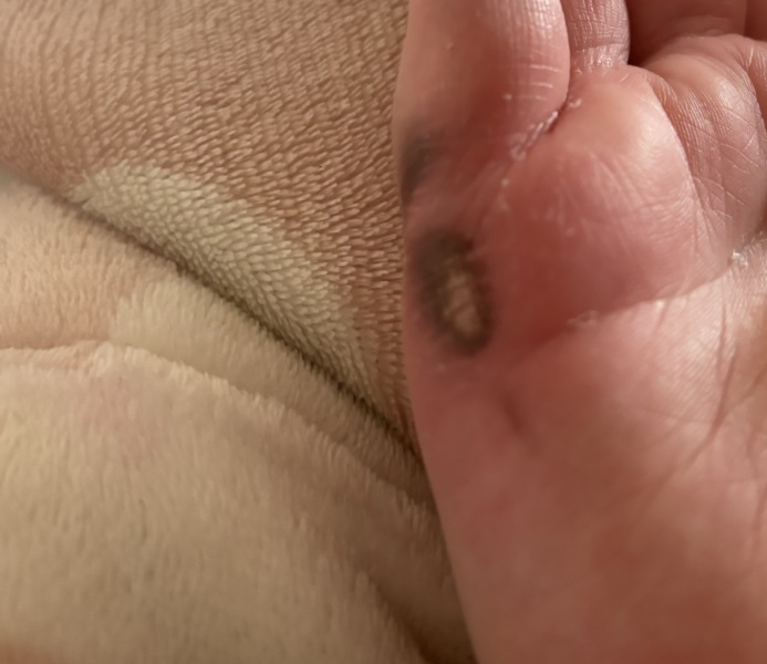 Would you get this looked at or just keep an eye? Photo
