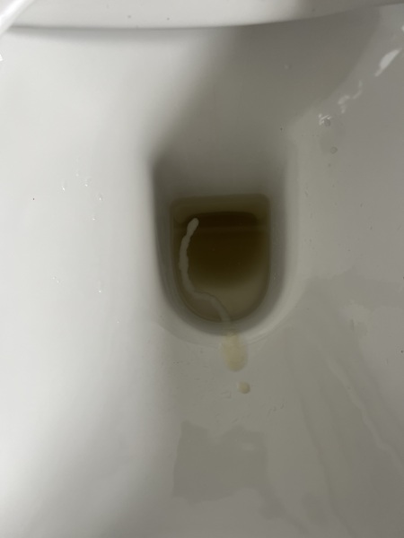 Help - does this look like a mucus plug?