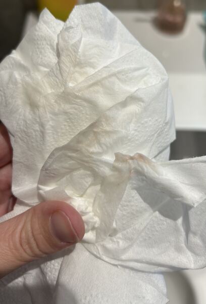 Implantation bleeding 5DPO