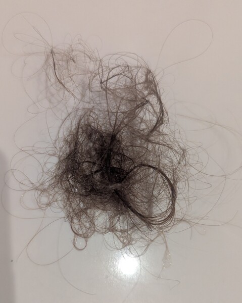 Minoxidil experiences please