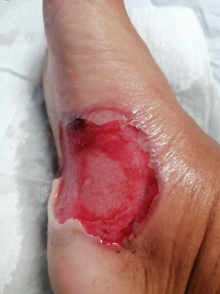 Does this need medical attention? (Yucky photo included)